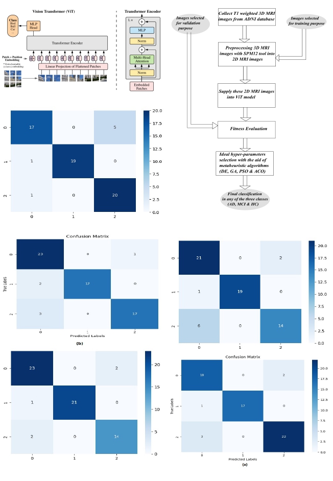 A comparative analysis on metaheuristic algorithms based vision transformer model for early detection of alzheimer's disease
