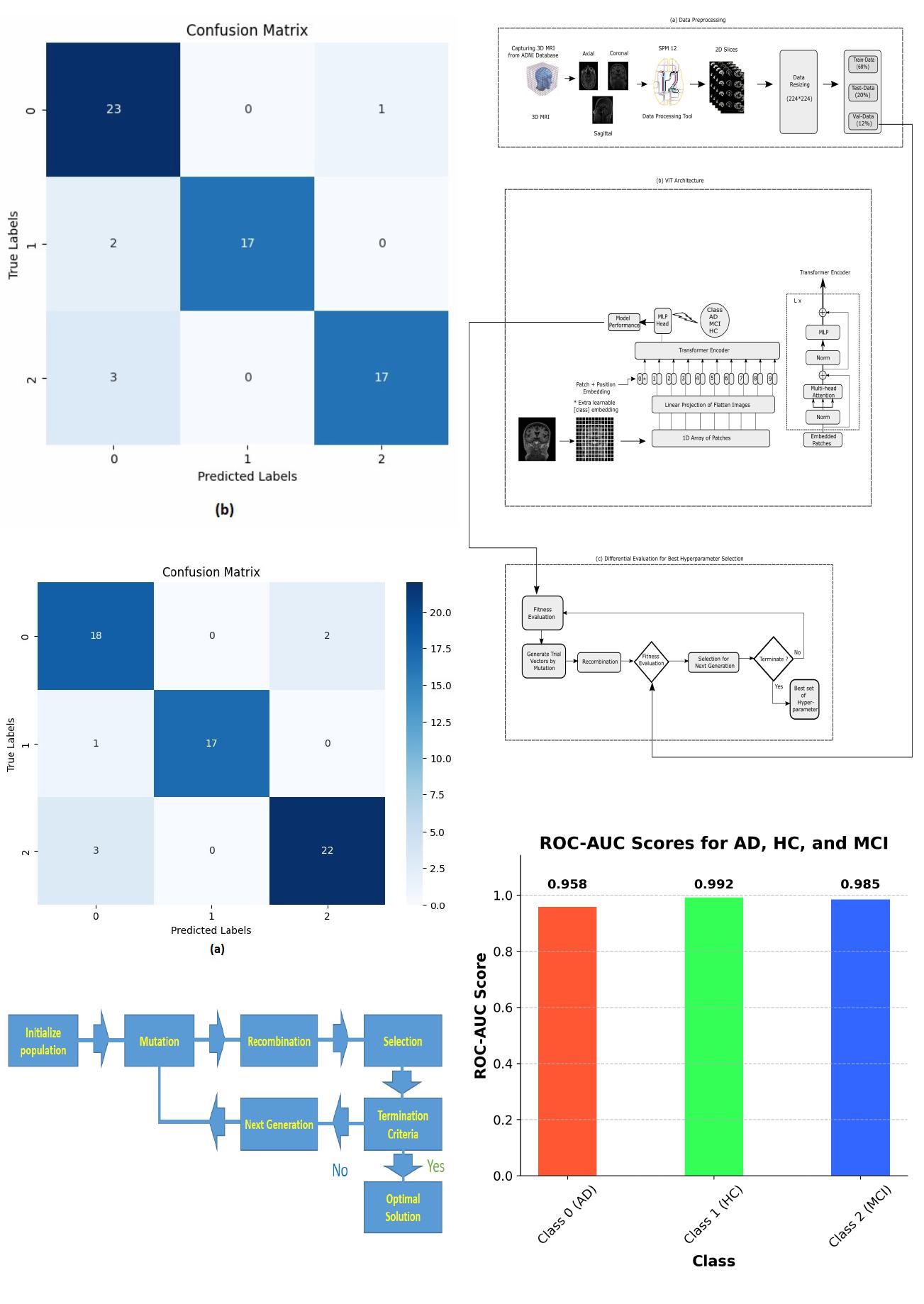 DE-ViT: State-Of-The-Art Vision Transformer Model for Early Detection of Alzheimer's Disease